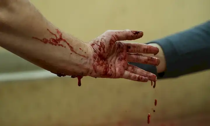Un plano de una mano humana con marcas de mordeduras, una expresión facial preocupada o asustada, esparcidores de sangre en la ropa o superficies cercanas, un fondo borroso para transmitir urgencia, un toque de caos y un fuerte énfasis en la vulnerabilidad de las víctimas